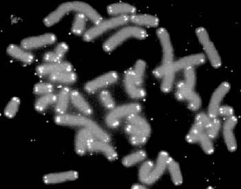 Kromosomer i gråt med telomerer for enden - de hvide pletter. Foto: Nasa